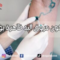 لماذا تكون عروق اليد ظاهرة بوضوح