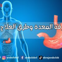 أسباب حرقة المعدة وطرق العلاج والوقاية